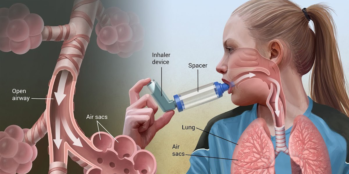 Asthma Inhaler Device Market Trends Stepping Up with a Competent CAGR Value