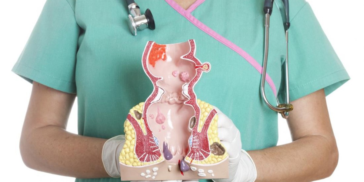 Hemorrhoids Treatment Market Trends Shows Extensive Expansion to Reach a Significant Value by 2030