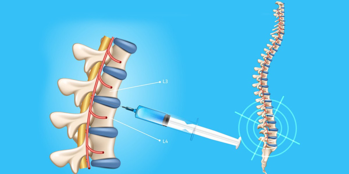 Spinal Needles Market Trends and Forecast | Research Report covers Global Industry Size & Share