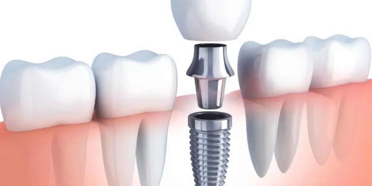 Navigating Affordable Dental Care: A Comprehensive Guide to Maintaining Oral Health on a Budget