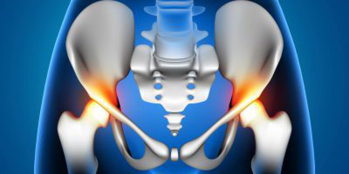 Choosing the Best Hip Replacement Surgeon: A Guide