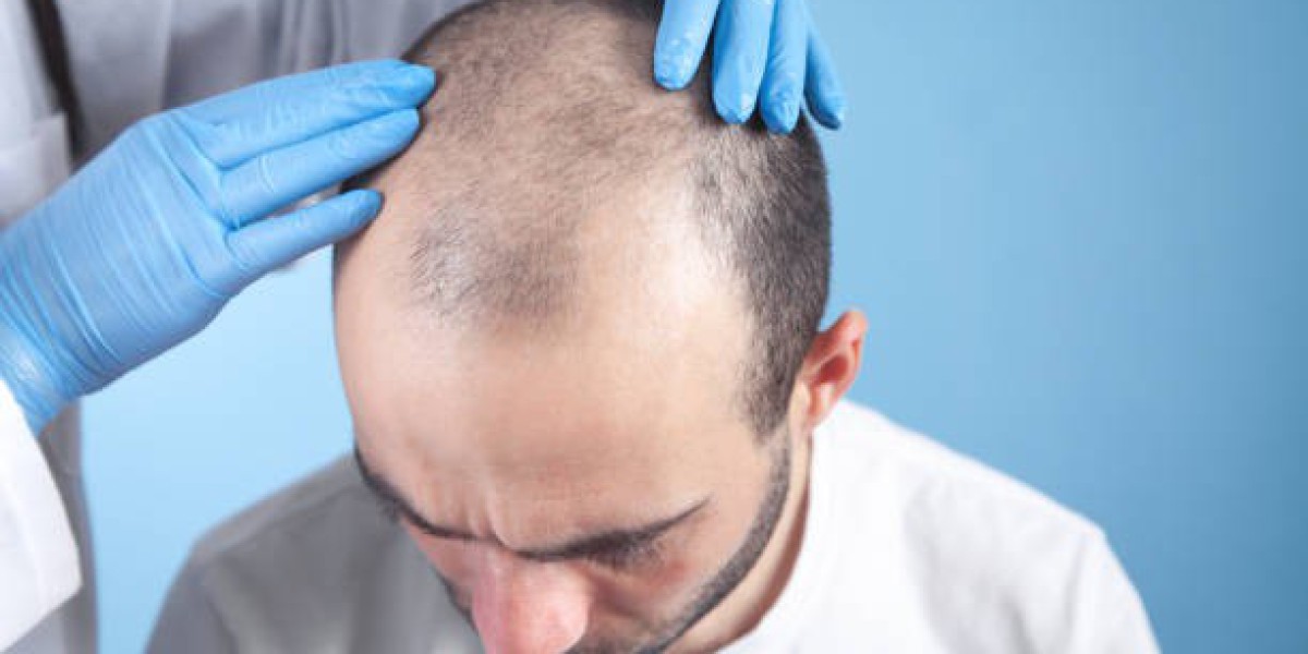 Is it possible to regrow hair? Ask an expert